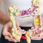 How to Repair Your Gut Naturally: 7 Steps That Actually Work Person holding a digestive system model.