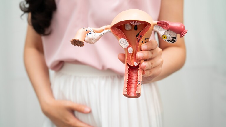 A woman holds an anatomical uterus and ovaries model in front of her lower abdomen, symbolizing PCOS, reproductive health, and hormonal wellness.